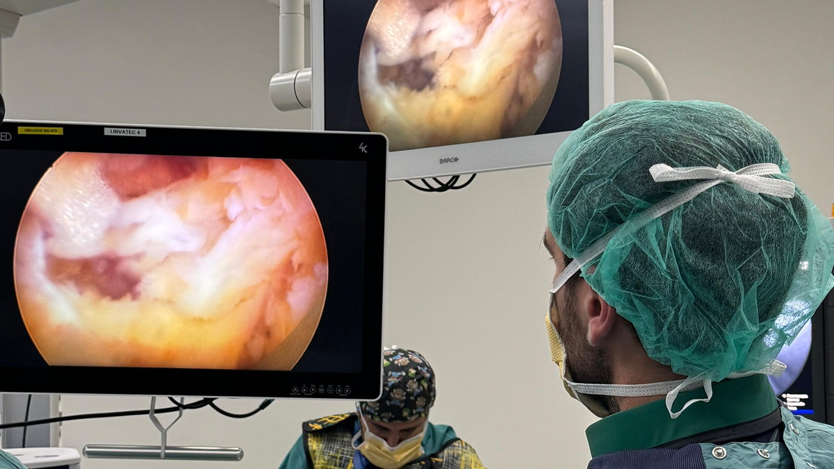 Cirurgia endoscòpica de columna