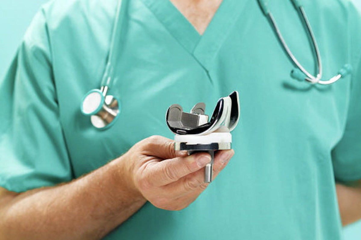 Navigation technology for knee replacement surgery